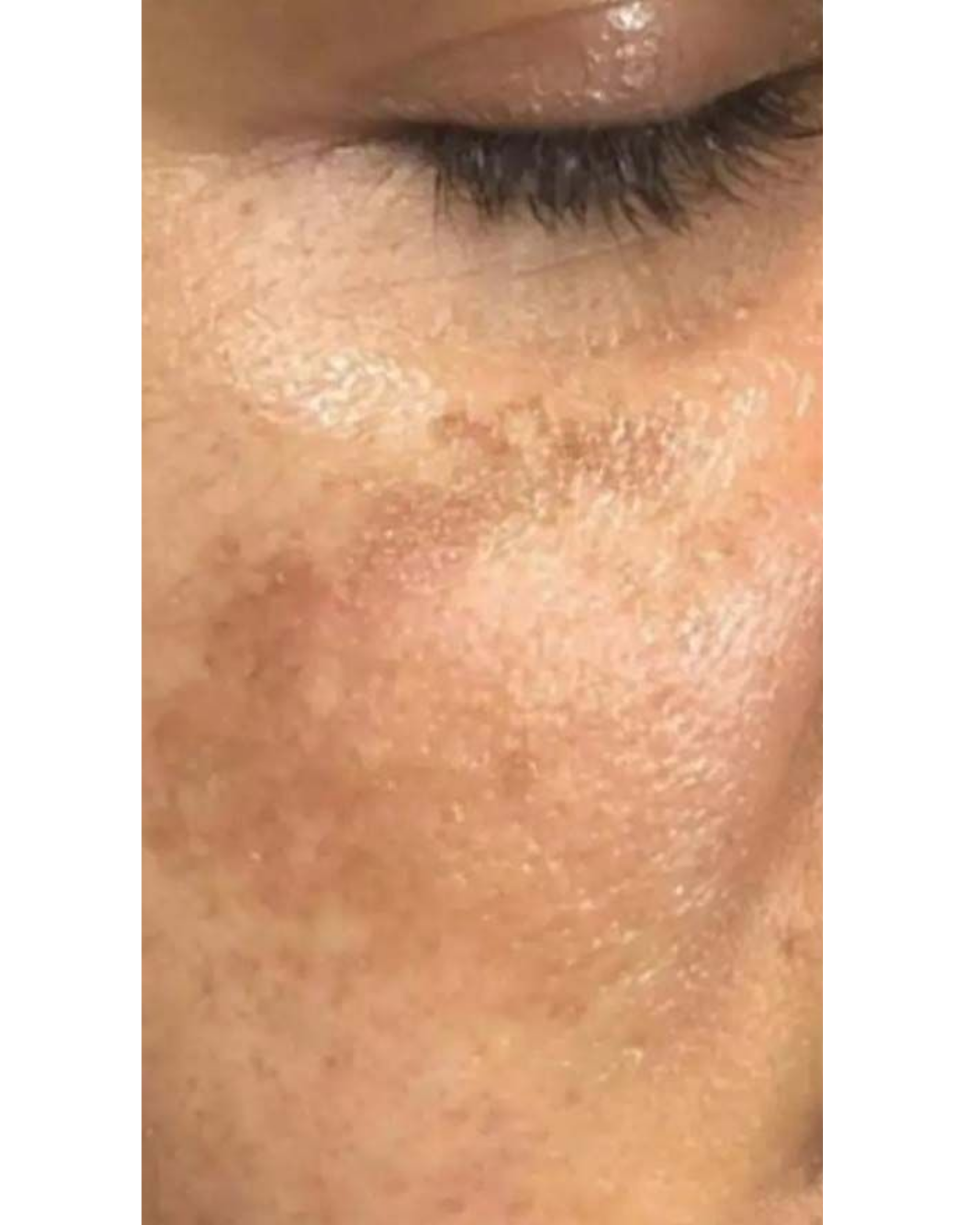 Derma wings (10) Derma wings (10)