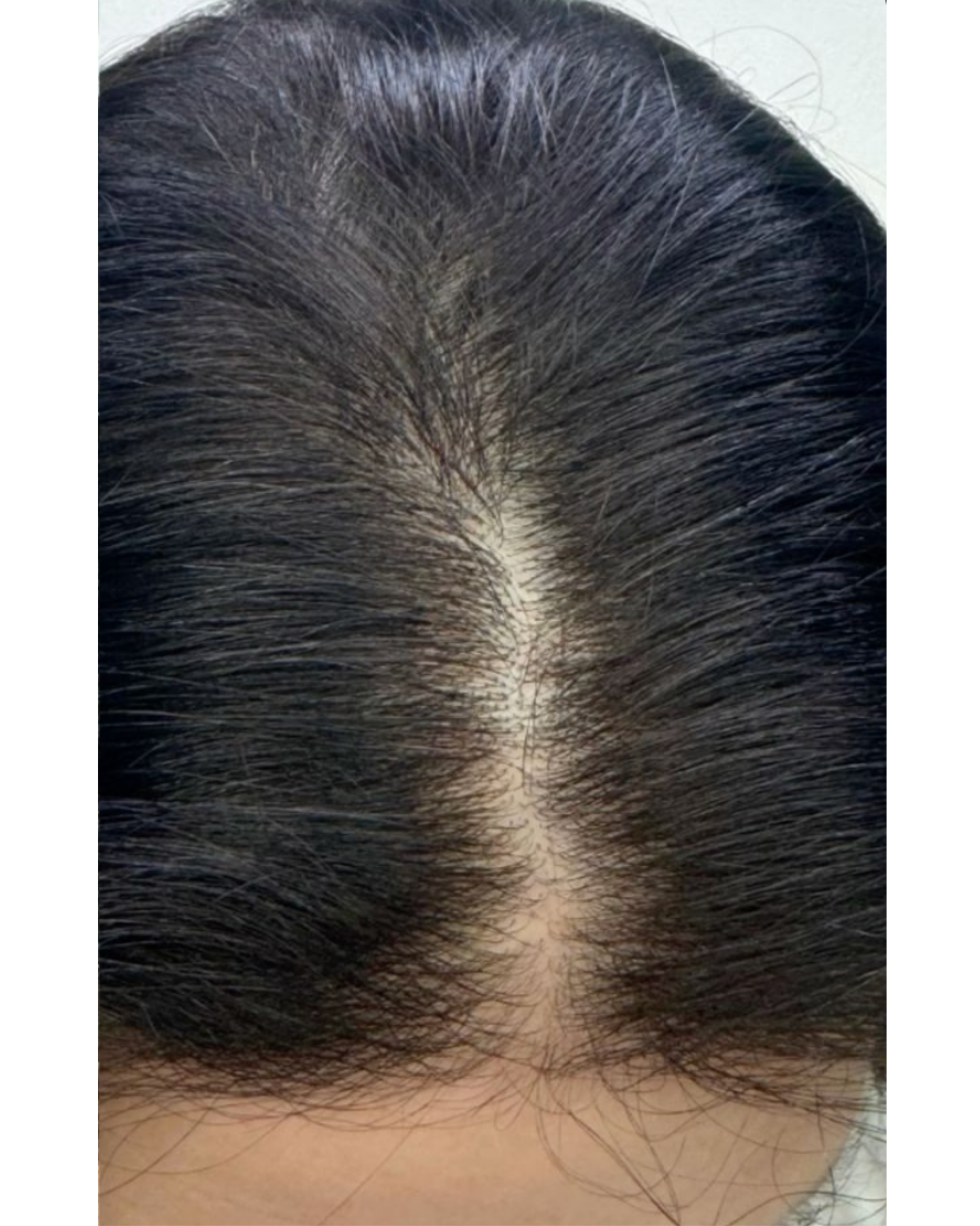 Derma wings (5)