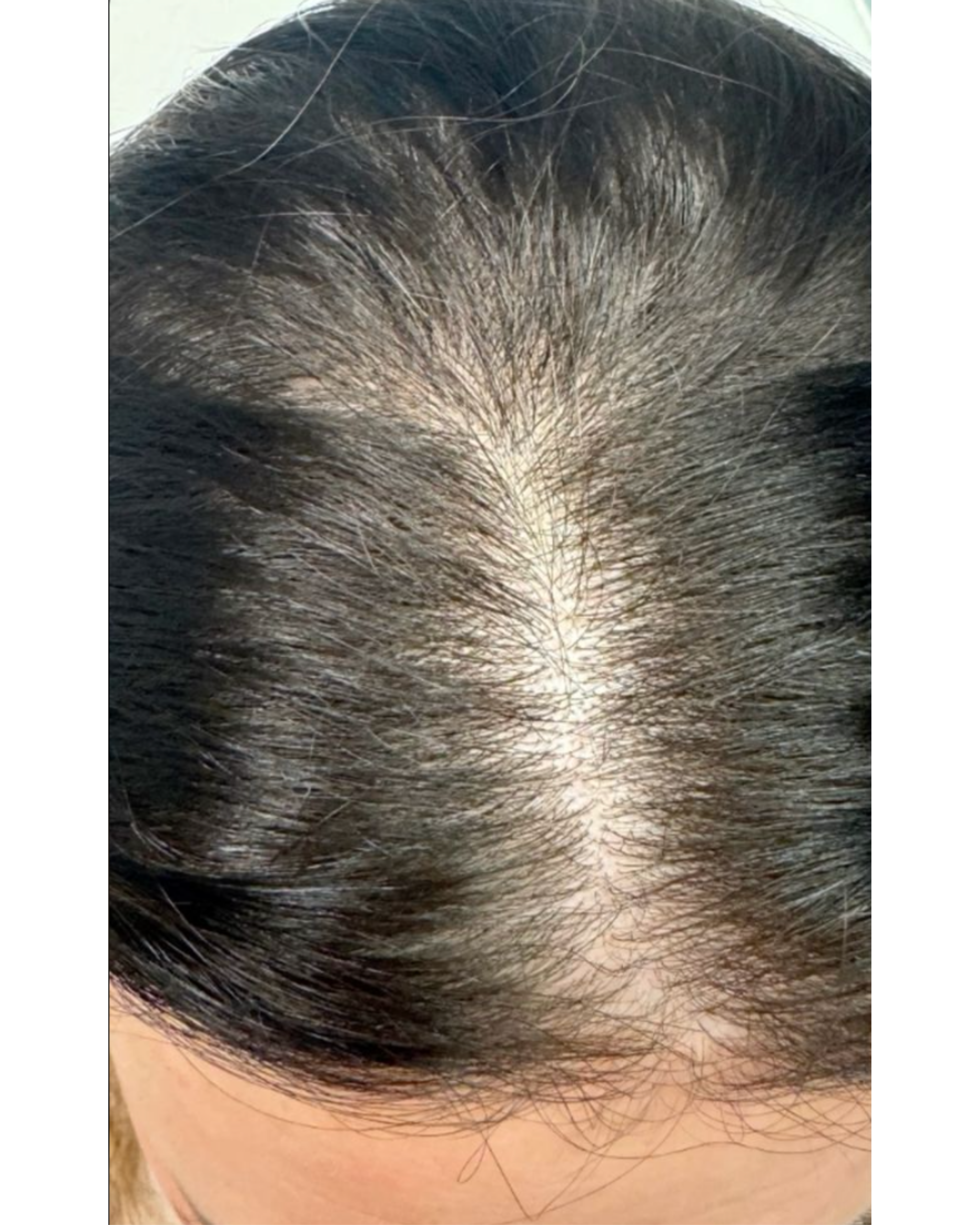 Derma wings (6) Derma wings (6)
