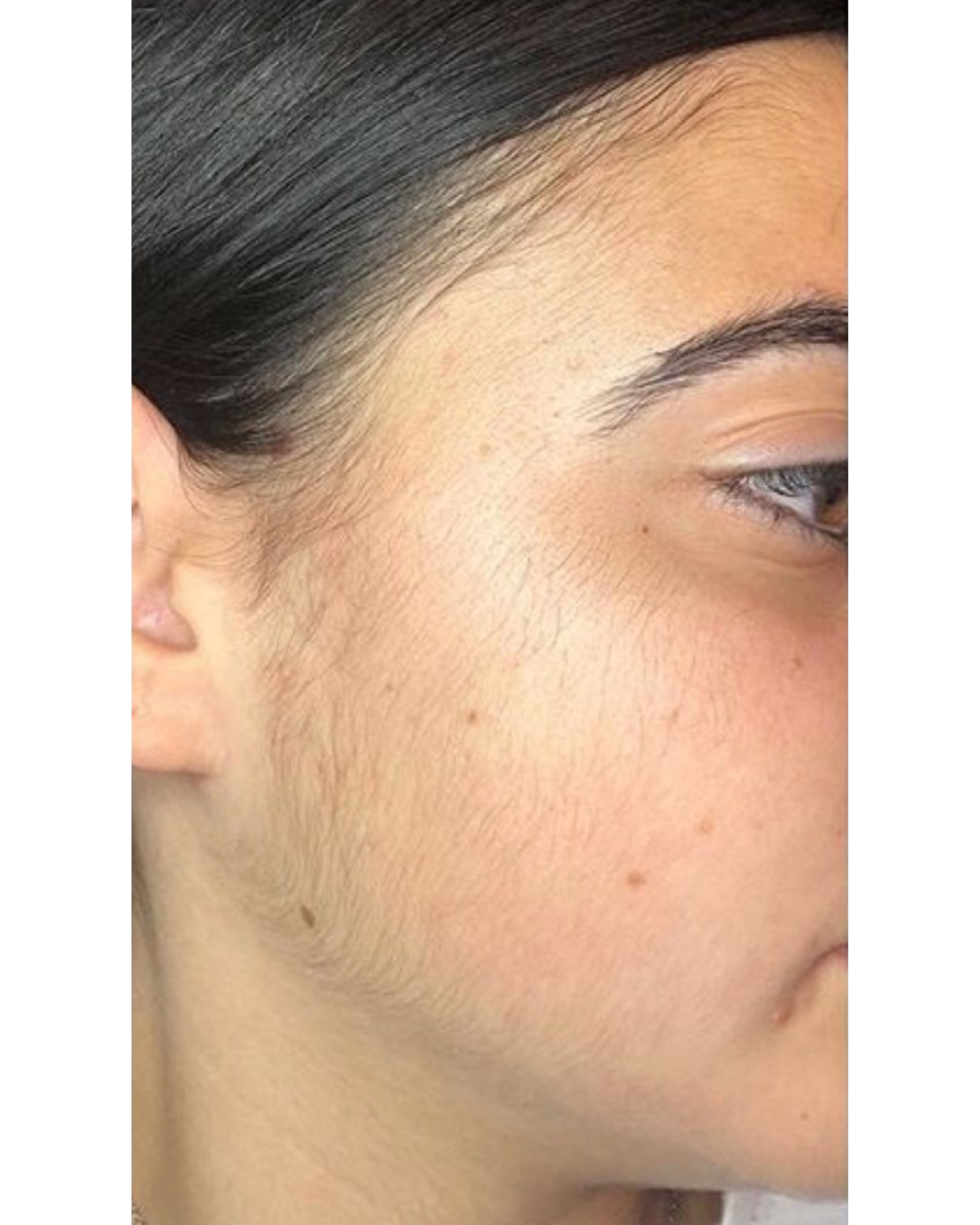 Derma wings (7) Derma wings (7)