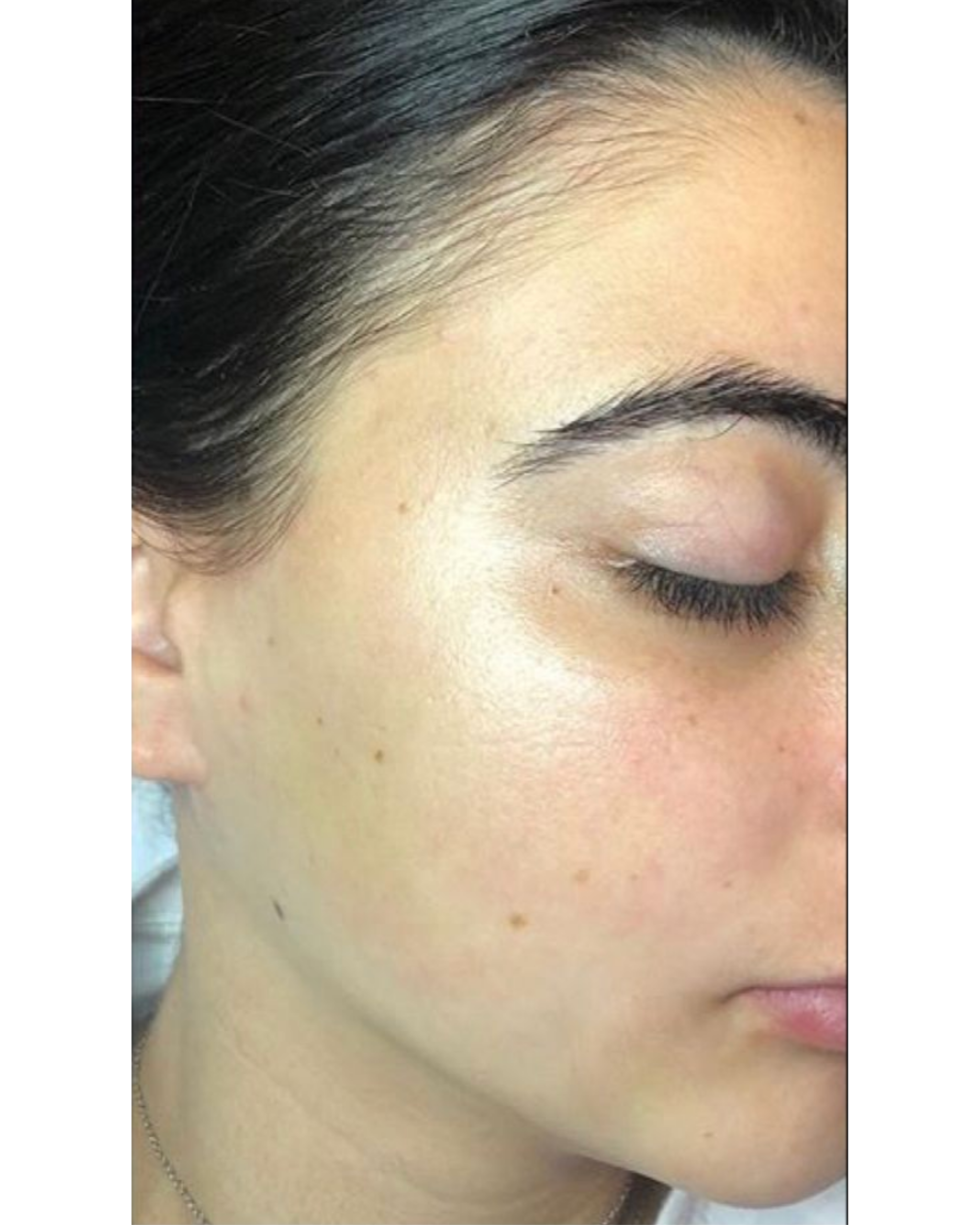 Derma wings (8)