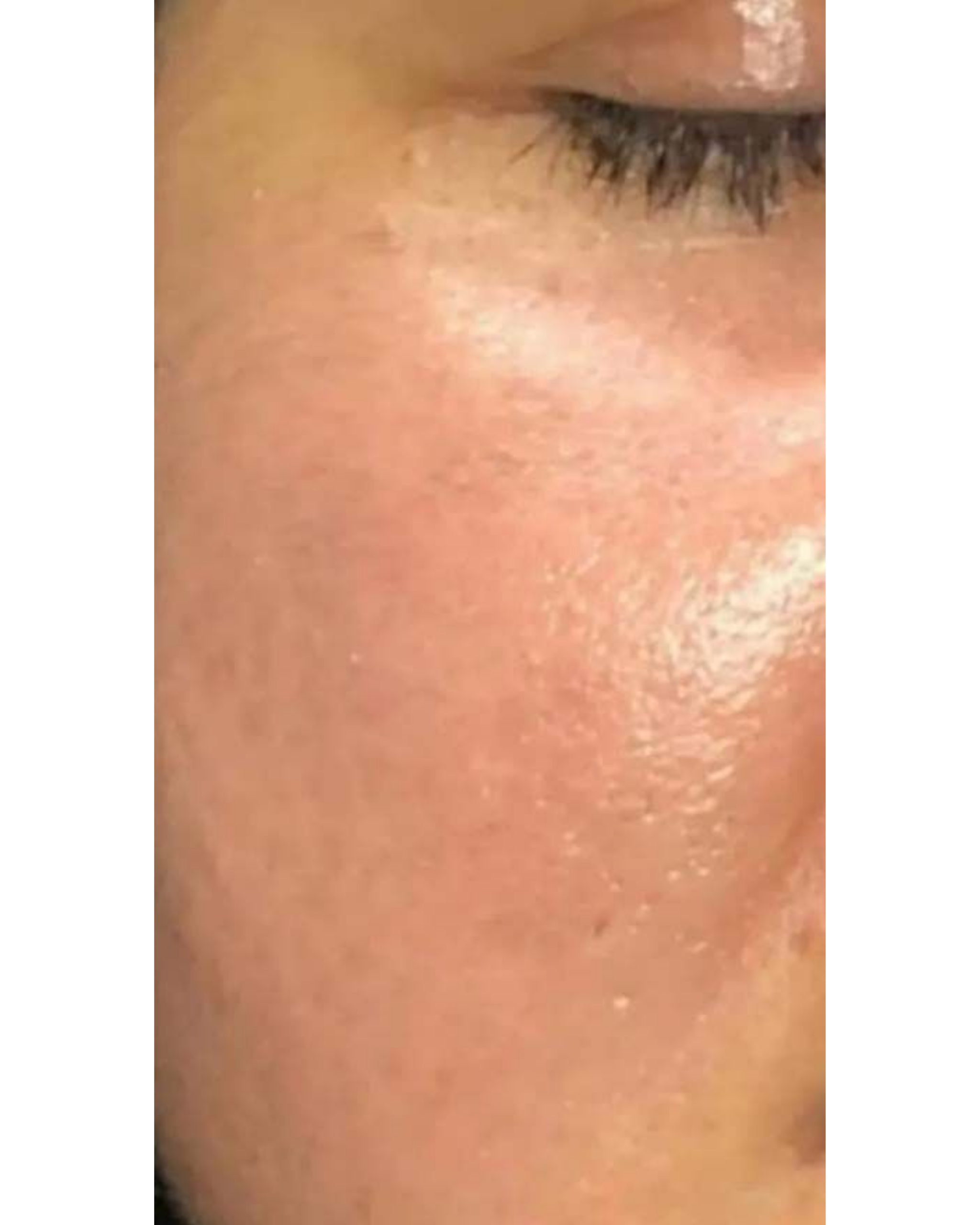 Derma wings (9)
